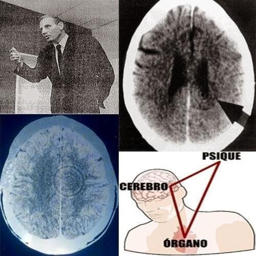 Nueva Medicina Germánica: Un Enfoque Integral de la Salud